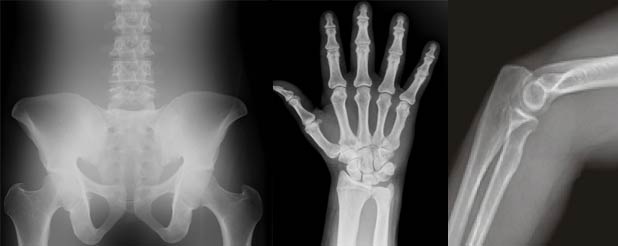 دکتر ناصر طالب زاده | رادیولوژیست