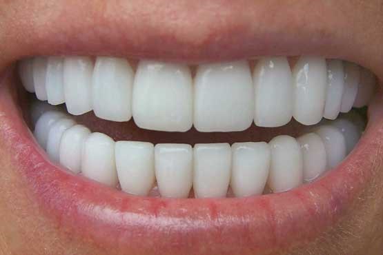 لابراتوار تخصصی پروتزهای دندانی