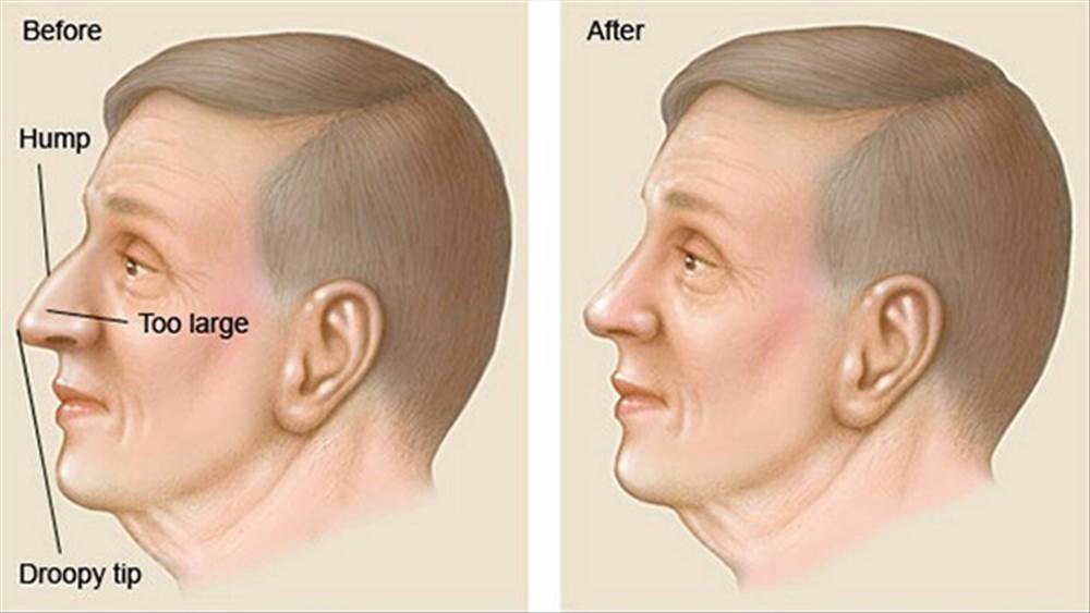 دکتر ابراهیم شیرزاده-جراح  گوش، حلق و بینی