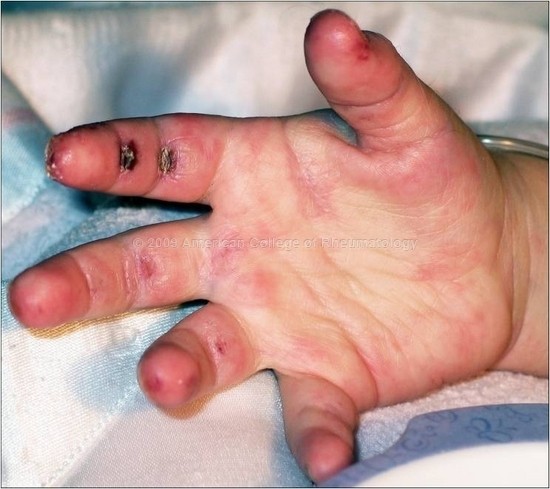 دکتر فرهاد فرزاد|متخصص روماتولوژی